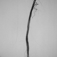 Angiographie 2