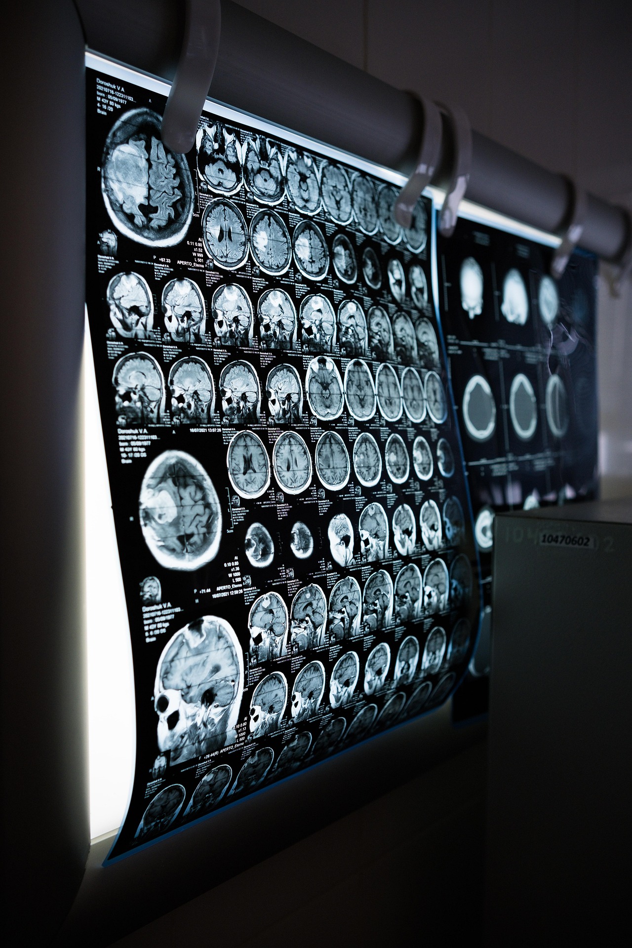Radiologie Norimagerie Radiologie en grève