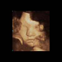 Echographie troisième trimestre 2
