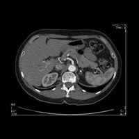 Scanner abdominopelvien 1