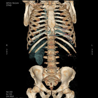 Scanner du corps entier 1
