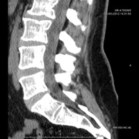 Scanner osteo-articulaire 3