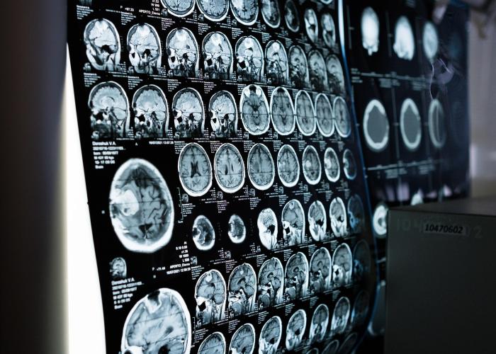 Radiologie en grève